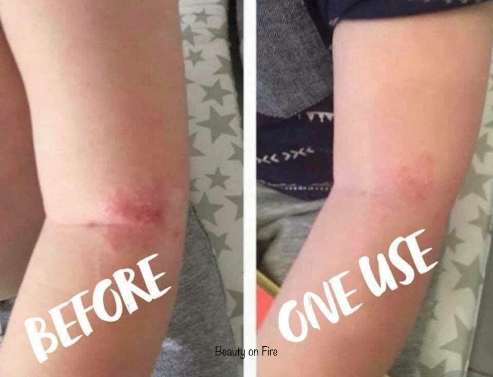 Body Butter