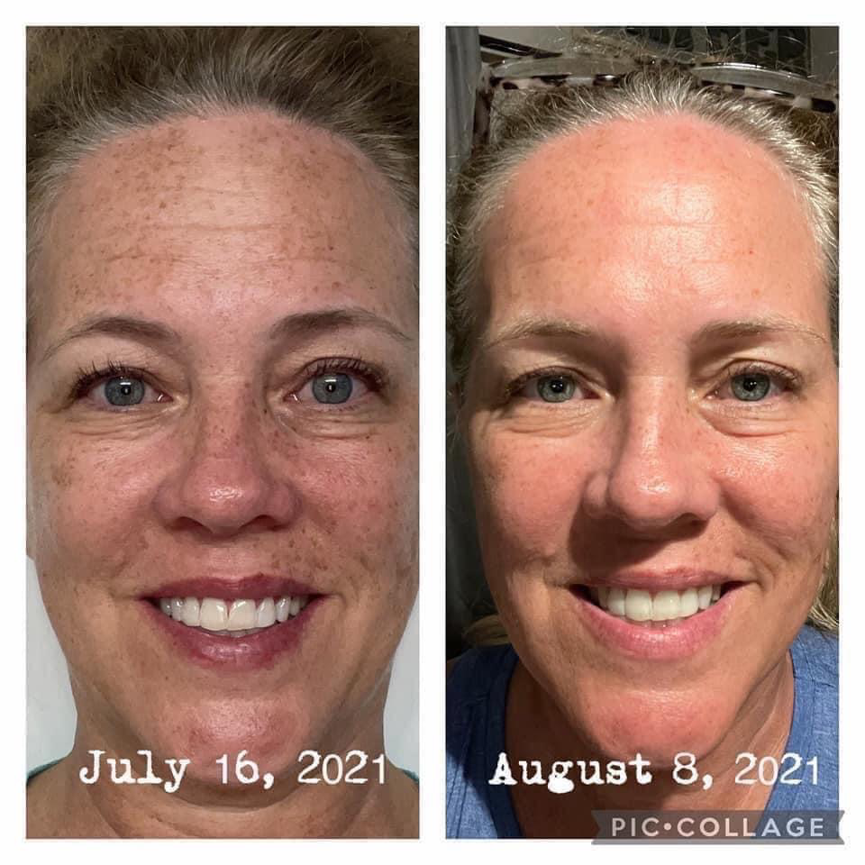 Beauty Focus Collagen+ Powder